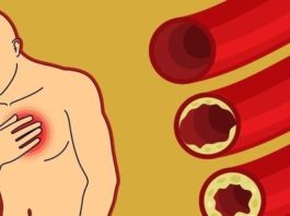 9 продуктов, которые естественным способом очищают артерии