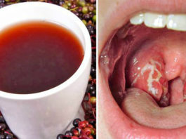 Натуральное средство против боли в горле: только 4 часа — и ангина исчезает напрочь!