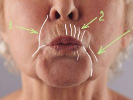 Как убрать глубокие морщины вокруг рта: 5 домашних масок, творящих чудеса с увядающей кожей