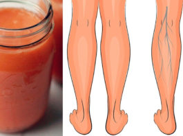 Эти три супер сока эффективно улучшают кровообращение в ногах, укрепляют вены и устраняют отёки